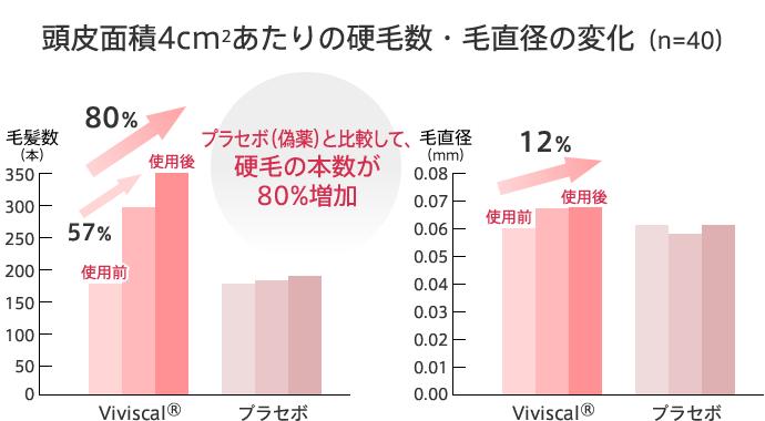 女性向けビビスカル プロ ・薄毛治療の聖心